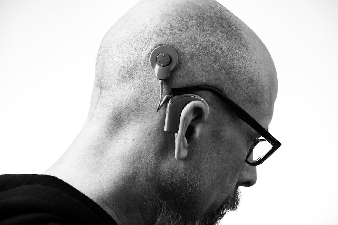 Ukraine Expands Free Cochlear Implant Surgery to More Patients
